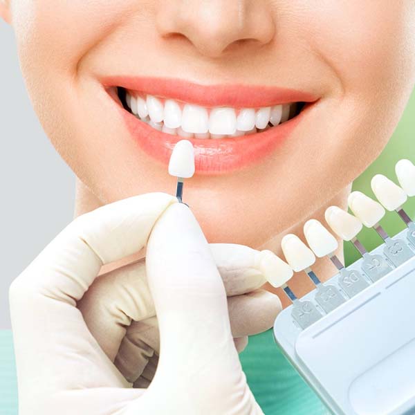 Dental Veneers and Digital Smile Design Makeover