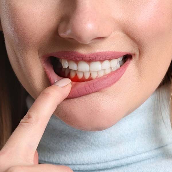 Gum Disease Treatment and Periodontal Therapy