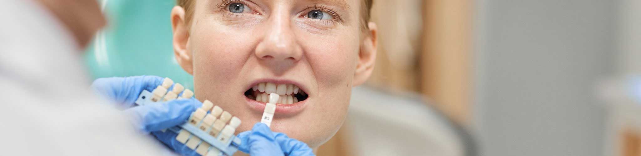 Professional In-Office Teeth Whitening